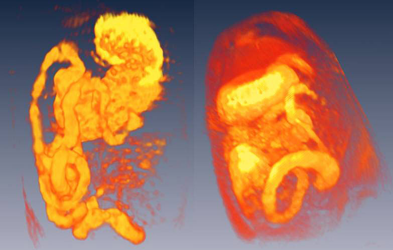 reconstructions of magnetic resonance images of the rat gastrointestinal tract
